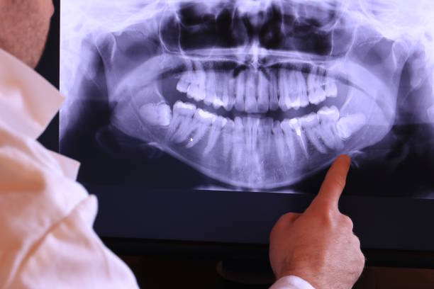 Best Emergency Denture Repair in Brooklyn, IA