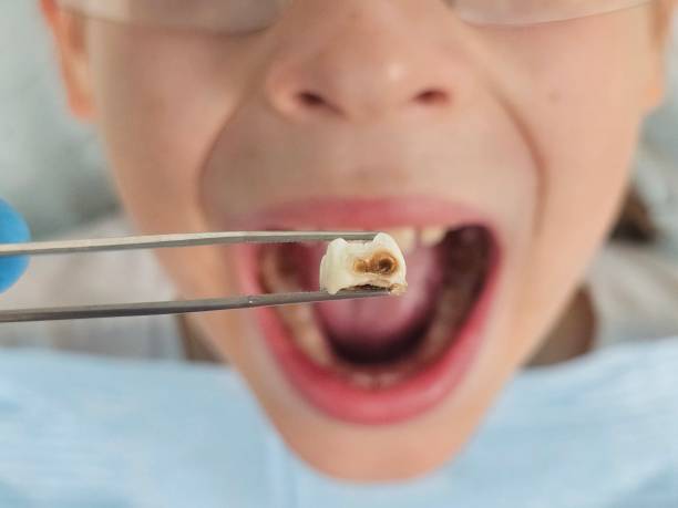 Best Broken or Chipped Tooth Repair in Brooklyn, IA